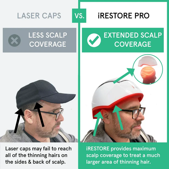 iRESTORE Hair Growth System Professional