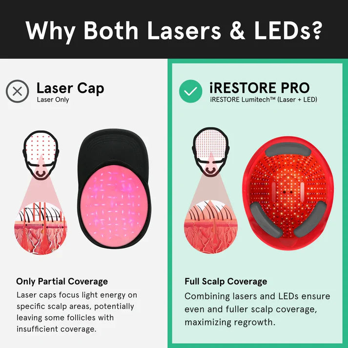 iRESTORE Hair Growth System Professional